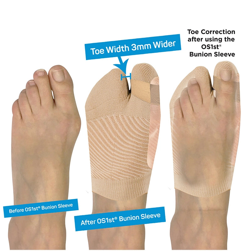 OS1st HV3 Bunion Bracing Sleeve use chart