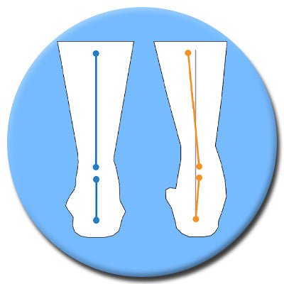Visual representation of supination vs. pronation