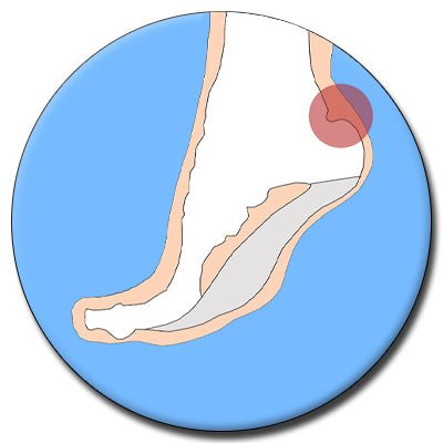 Achilles Tendinitis - The Insole Store