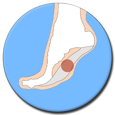 Flat Feet & Fallen Arches - The Insole Store