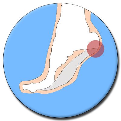 Heel Pain & Heel Spurs - The Insole Store