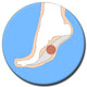 Plantar Fasciitis