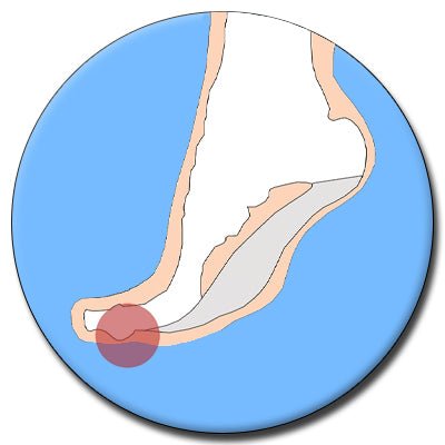 Turf Toe - The Insole Store